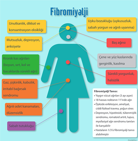 Fibromiyalji Belirtileri
